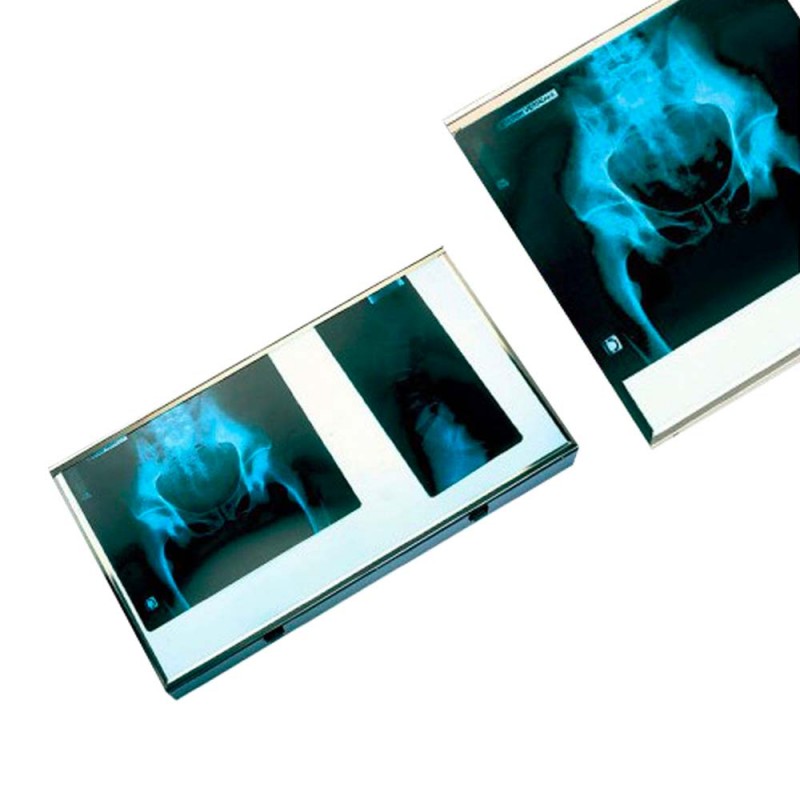 Négatoscope 1 Plage