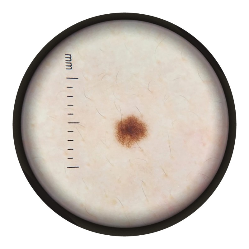 Dermatoscope - DERMA MED 30