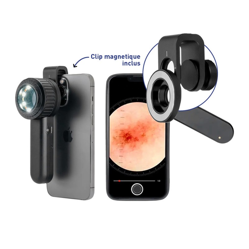 Dermatoscope - DERMA MED 30