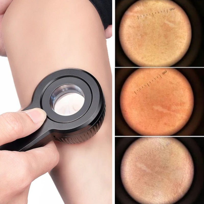 Dermatoscope - DERMA MED 30