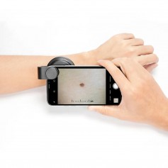 Dermatoscope - DERMA MED 20