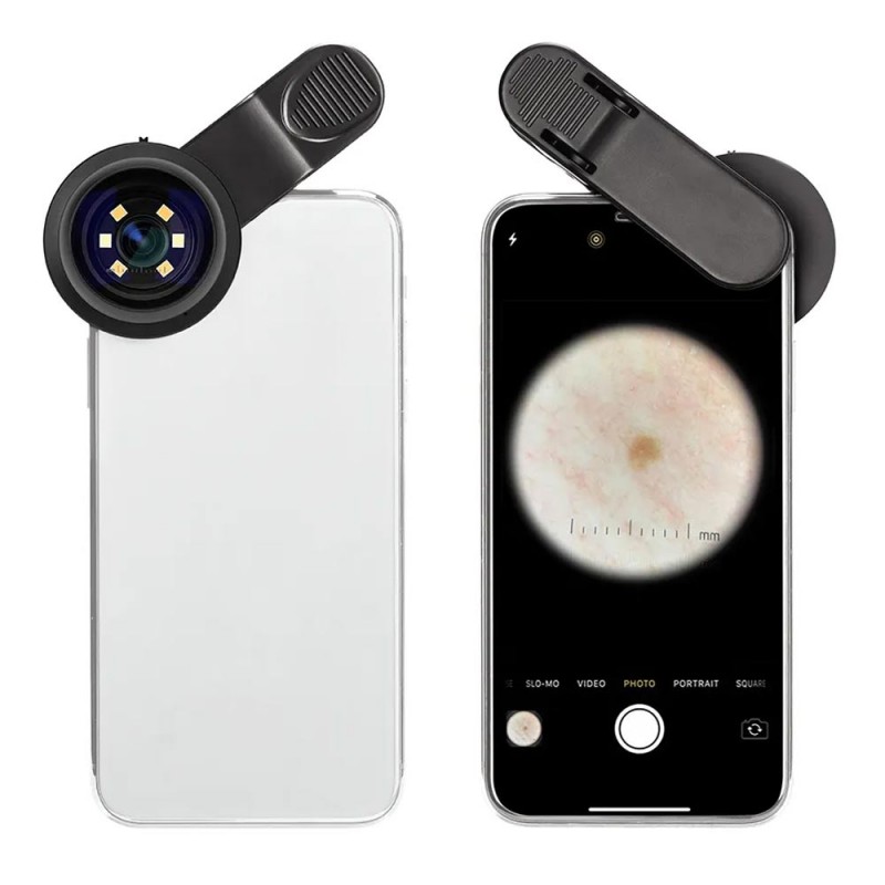 Dermatoscope - DERMA MED 20