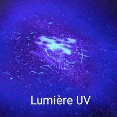 LAMPE DE WOOD AVEC LOUPE