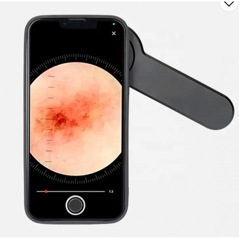 Dermatoscope -DERMA MED 40