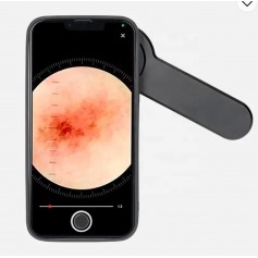 Dermatoscope -DERMA MED 40