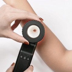 Dermatoscope -DERMA MED 40