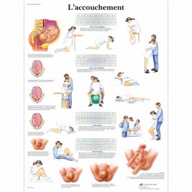 Planche Anatomique l'accouchement