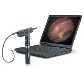 OTOSCOPE MACROVIEW DIGITAL