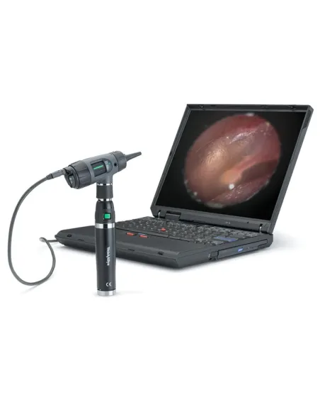 OTOSCOPE MACROVIEW DIGITAL