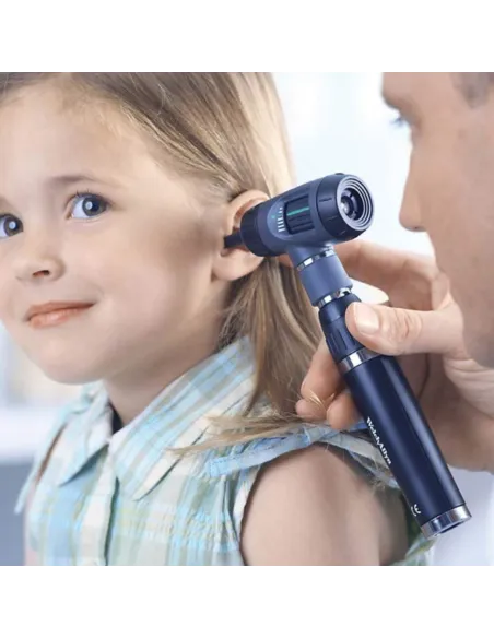 OTOSCOPE MACROVIEW BATTERIE LITHIUM