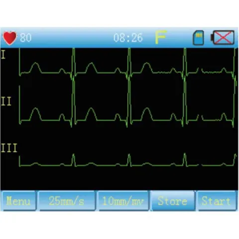ECG 3 Pistes Portatif 90A CONTEC - Compact et Précis | LD Medical
