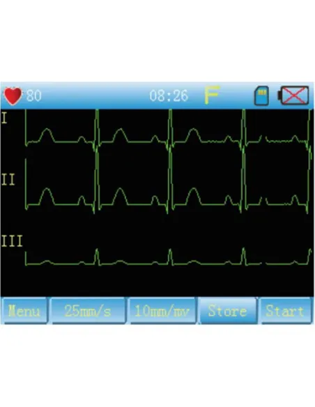 ECG 3 Pistes Portatif 90A CONTEC - Compact et Précis | LD Medical