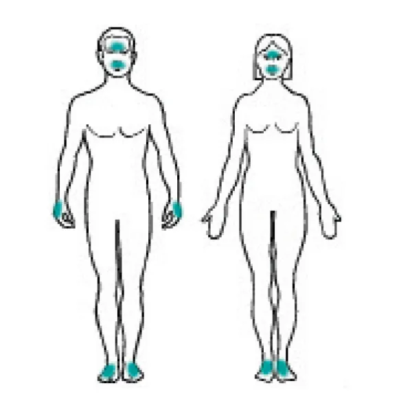 Aiguilles d’épilation K2 BALLET stériles CE - boîte de 50
