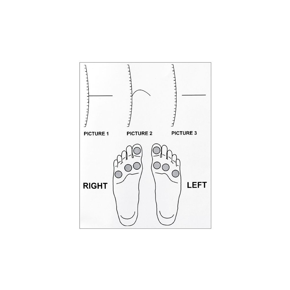 Stylet monofilament évaluateur sensoriel Gima LD Medical