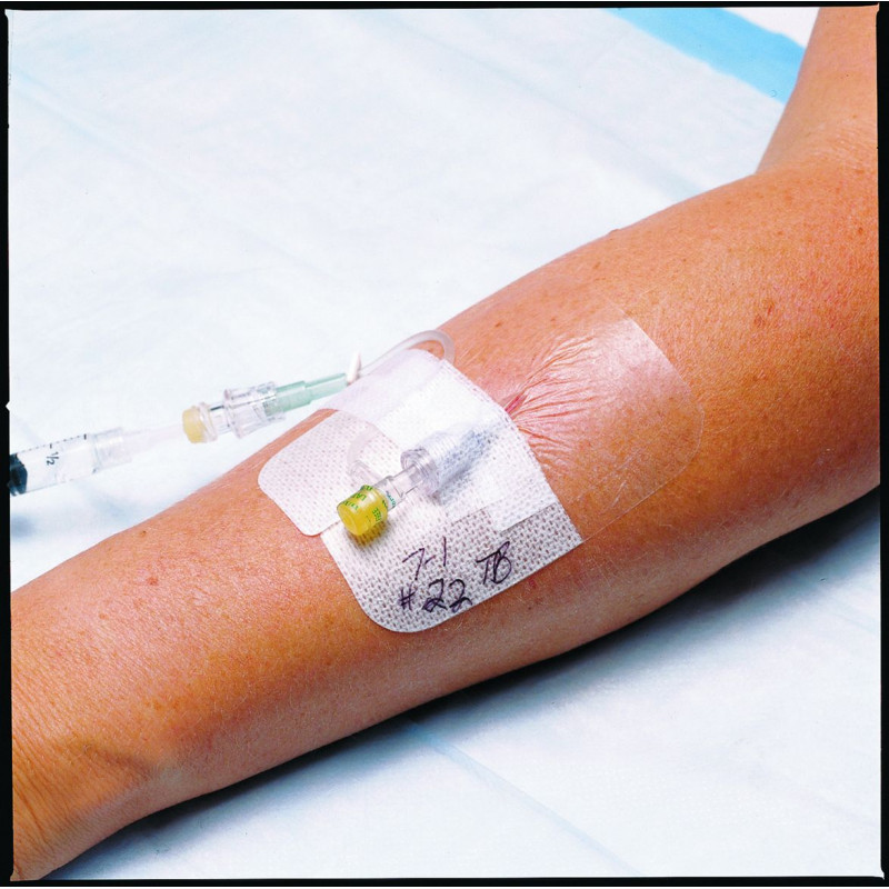 Pansement Tegaderm™ 3M™ Film