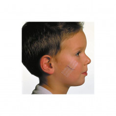 Suture adhésive Steri-Strip™ 3M™ pansement cicatrisant