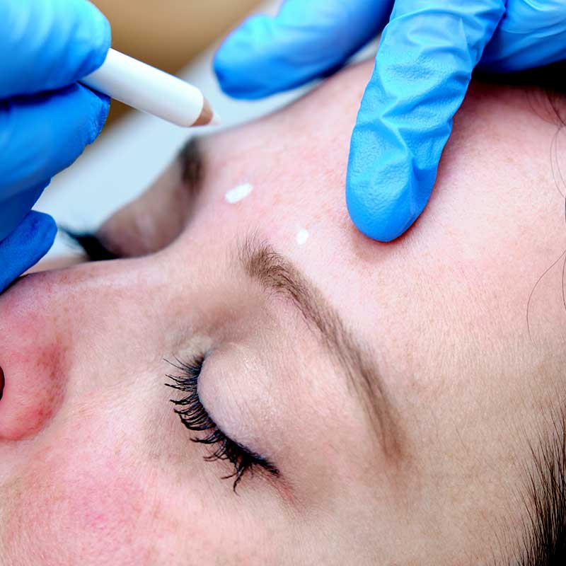 Crayon dermographique