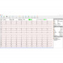 ECG Cardiomate PC SPENGLER