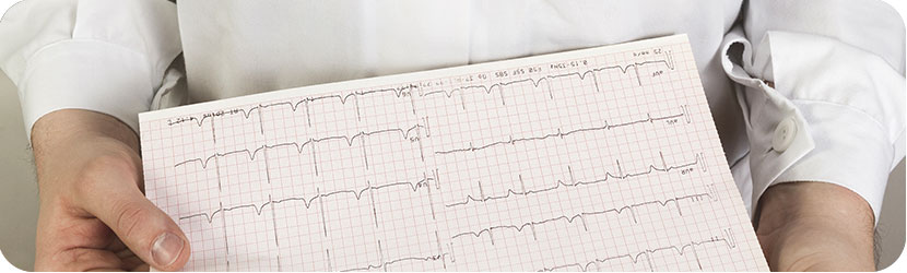 Comment lire un ECG