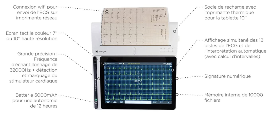 Schéma de la tablette ECG Cardiomate