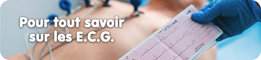 Base de connaissance sur les ECG