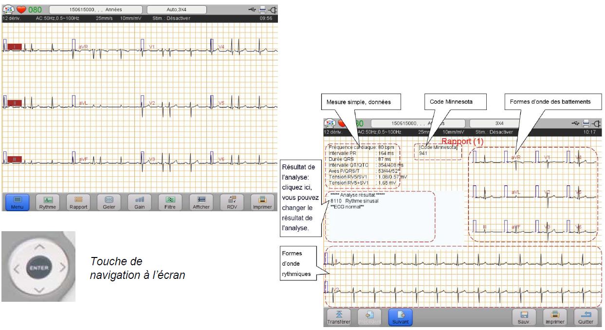 image écran ECG pro Wepp