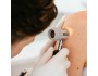 La télédermatologie