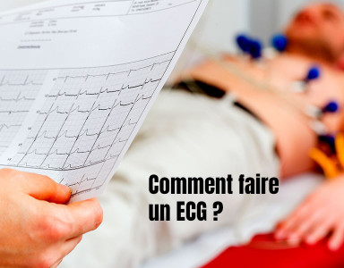 Comment faire une électrocardiogramme (ECG) ?